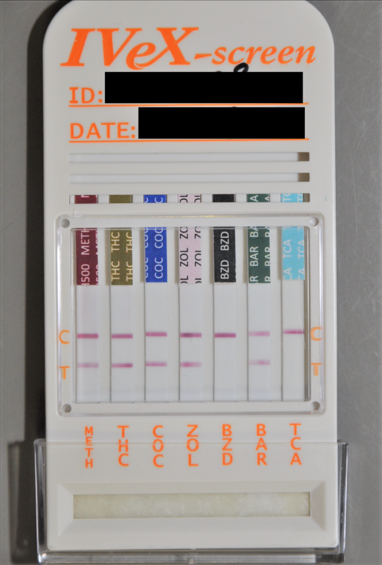 thumbnail_drug_toxicology_test 東海大学医学部基盤診療学系法医学